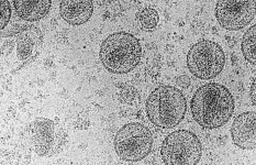 aidsvirus_1116114i.jpg