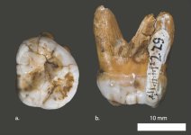 Tooth1.jpg