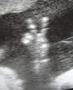 baby peace sign ultrasound cropped.jpg